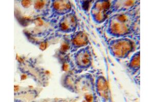 Used in DAB staining on fromalin fixed paraffin- embedded stomach tissue (CCL13 Antikörper  (AA 24-98))