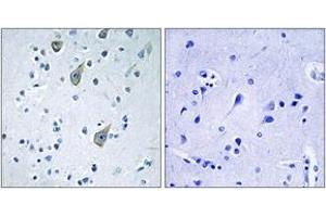 Immunohistochemistry analysis of paraffin-embedded human brain tissue, using FZD6 Antibody. (FZD6 Antikörper  (AA 116-165))