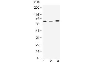 Western blot testing of 1) rat spleen, 2) mouse spleen and 3) human COLO320 lysate with 12 Lipoxygenase antibody at 0. (12-Lipoxygenase Antikörper  (AA 186-231))