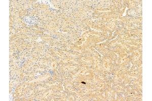 ABIN6263730 and ABIN6266924 at 1/100 staining Rat kidney tissue by IHC-P.