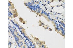 Immunohistochemistry of paraffin-embedded Mouse lung using IL36G Polyclonal Antibody at dilution of 1:100 (40x lens). (IL1F9 Antikörper)