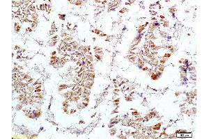 Formalin-fixed and paraffin embedded rat intestine tissue labeled with Anti OTC Polyclonal Antibody, Unconjugated (ABIN720505) at 1:200 followed by conjugation to the secondary antibody and DAB staining