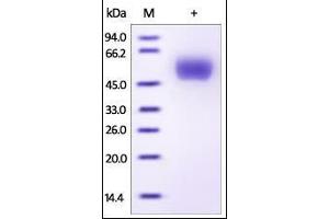 Human Clusterin, His Tag on SDS-PAGE under reducing (R) condition. (Clusterin Protein (CLU) (AA 23-449) (His tag))