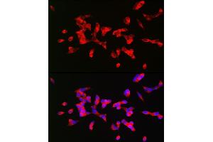 Immunofluorescence analysis of SH-SY5Y cells using CHRM1 Rabbit pAb (ABIN3022210, ABIN3022211, ABIN3022212, ABIN1512760 and ABIN6218670) at dilution of 1:200 (40x lens). (CHRM1 Antikörper  (C-Term))