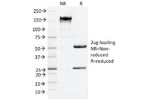 SDS-PAGE (SDS) image for anti-CD9 (CD9) antibody (ABIN6941086)
