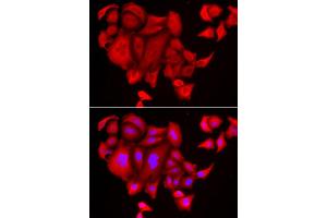 Immunofluorescence analysis of HeLa cell using SLC26A2 antibody. (SLC26A2 Antikörper)