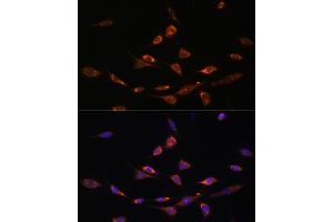 Immunofluorescence analysis of NIH-3T3 cells using P antibody (ABIN7269162) at dilution of 1:100. (PAK3 Antikörper  (AA 1-100))