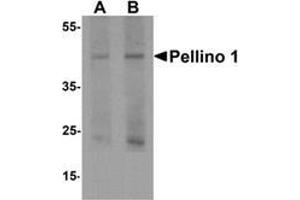 Western blot analysis of Pellino 1 in human liver tissue lysate with Pellino 1 Antibody  at (A) 1 and (B) 2 μg/ml. (Pellino 1 Antikörper  (C-Term))