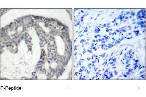 Image no. 1 for anti-Nitric Oxide Synthase 3 (Endothelial Cell) (NOS3) (pSer1177) antibody (ABIN319232) (ENOS Antikörper  (pSer1177))