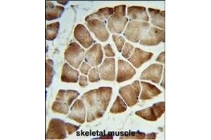 Formalin-fixed and paraffin-embedded human skeletal muscle reacted with COQ3 Antibody (Center), which was peroxidase-conjugated to the secondary antibody, followed by DAB staining. (COQ3 Antikörper  (AA 172-201))