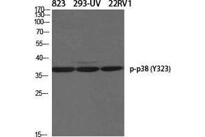Western Blot (WB) analysis of specific cells using Phospho-p38 (Y323) Polyclonal Antibody.