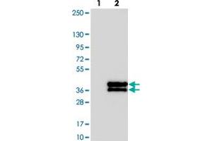Western blot analysis of Lane 1: Negative control (vector only transfected HEK293T lysate). (KIF25 Antikörper)