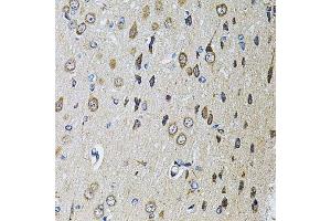 Immunohistochemistry (Paraffin-embedded Sections) (IHC (p)) image for anti-Protein tyrosine Phosphatase, Receptor Type, E (PTPRE) (AA 20-200) antibody (ABIN6146460)