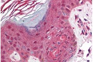 Human Skin (formalin-fixed, paraffin-embedded) stained with PDCD1 antibody ABIN214464 at 2. (PD-1 Antikörper  (C-Term))