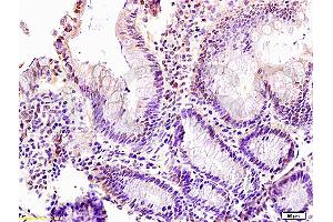 Formalin-fixed and paraffin: rat intestine tissue labeled with Anti-LZTFL1 Polyclonal Antibody (ABIN755407), Unconjugated at at 1:200 followed by conjugation to the secondary antibody and DAB staining