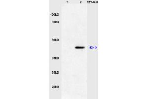 Lane 1: mouse heart lysates Lane 2: mouse S/P20 cell lysates probed with Anti phospho-ERK1(Thr202/Tyr204) +ERK2(Thr183/Tyr185) Polyclonal Antibody, Unconjugated (ABIN732458) at 1:200 in 4 °C.