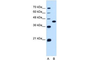 WB Suggested Anti-SLC14A1 Antibody Titration:  0.