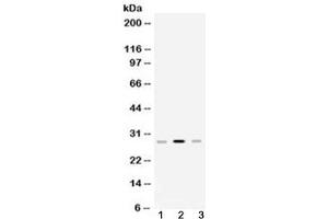 Western blot testing of 1) rat spleen, 2) mouse spleen and 3) human Jurkat lysate with HLA-DPB1 antibody at 0.