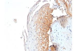 Immunohistochemistry (IHC) image for anti-CD9 (CD9) antibody (ABIN6941084)
