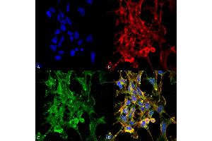 Immunocytochemistry/Immunofluorescence analysis using Mouse Anti-Citrulline Monoclonal Antibody, Clone 6C2. (Citrulline Antikörper  (PE))