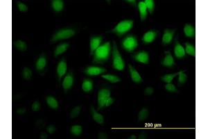 Immunofluorescence (IF) image for anti-Protein Geranylgeranyltransferase Type I, beta Subunit (PGGT1B) (AA 1-105) antibody (ABIN562194)