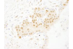 Immunohistochemistry (IHC) image for anti-SET Domain Containing 8 Pseudogene 1 (SETD8P1) (AA 316-366) antibody (ABIN7448789)