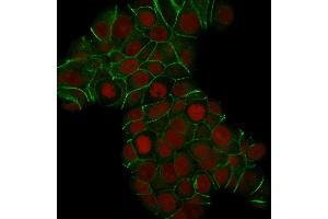 Confocal Immunofluorescence of MCF-7 cells E-Cadherin Mouse Monoclonal Antibody (CDH1/1525). (E-cadherin Antikörper)