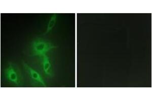 Immunofluorescence analysis of HeLa cells, using AS250 Antibody. (RALGAPA2 Antikörper  (AA 641-690))