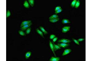 Immunofluorescent analysis of HepG2 cells using ABIN7149074 at dilution of 1:100 and Alexa Fluor 488-congugated AffiniPure Goat Anti-Rabbit IgG(H+L) (CysLTR1 Antikörper  (AA 298-337))