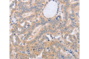 Immunohistochemistry (IHC) image for anti-Bone Marrow Stromal Cell Antigen 1 (BST1) antibody (ABIN2432738) (BST1 Antikörper)