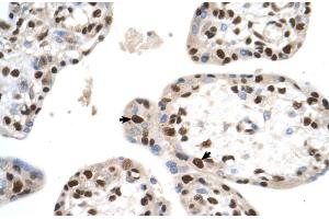 SETD2 antibody - N-terminal region  validated by IHC using Human Placenta lysate at 4. (SETD2 Antikörper  (N-Term))