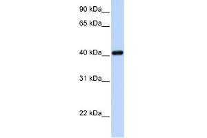 WB Suggested Anti-IRX6 Antibody Titration:  0. (IRX6 Antikörper  (N-Term))