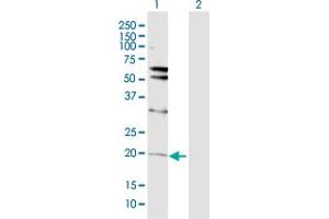 Western Blot analysis of VHL expression in transfected 293T cell line by VHL MaxPab polyclonal antibody.