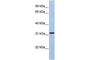 WB Suggested Anti-SLC25A28 Antibody Titration:  1 ug/ml  Positive Control:  MCF-7 whole cell lysates (SLC25A28 Antikörper  (C-Term))