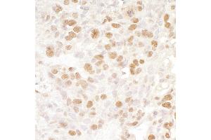 Immunohistochemistry (IHC) image for anti-Bromodomain Containing 4 (BRD4) (AA 1312-1362) antibody (ABIN7448442)