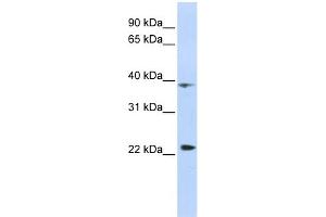 WB Suggested Anti-PRR11 Antibody Titration:  0. (PRR11 Antikörper  (Middle Region))