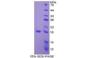 SDS-PAGE (SDS) image for Interleukin 31 (IL31) (AA 28-154) protein (His tag) (ABIN2125493)