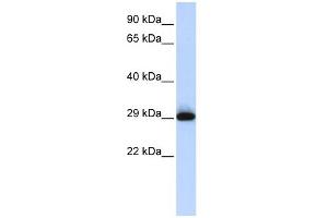 WB Suggested Anti-SUSD3 Antibody Titration: 0. (SUSD3 Antikörper  (N-Term))