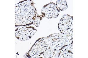 Immunohistochemistry of paraffin-embedded human placenta using [KO Validated] PDCD4 Rabbit pAb (ABIN3023387, ABIN3023388, ABIN3023389 and ABIN1681284) at dilution of 1:25 (40x lens). (PDCD4 Antikörper  (AA 1-260))