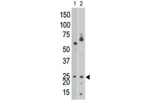 The BNIP3 antibody western blot analysis of Ramos cell lysate (lane 1) and in mouse brain tissue lysate (2). (BNIP3 Antikörper  (AA 152-187))