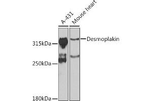 Western blot analysis of extracts of various cell lines, using Desmoplakin antibody (ABIN6134106, ABIN6139838, ABIN6139840 and ABIN6223548) at 1:1000 dilution.