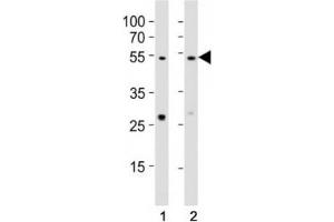 Western blot testing of EED antibody at 1:1000 dilution. (EED Antikörper  (AA 269-303))