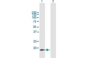 Western Blot analysis of APOBEC3C expression in transfected 293T cell line by APOBEC3C MaxPab polyclonal antibody.