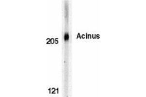 Western blot analysis of Acinus in K562 whole cell lysate with AP30011PU-N Acinus antibody at 0.