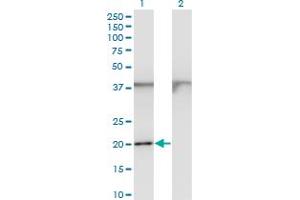 Western Blot analysis of FTL expression in transfected 293T cell line by FTL monoclonal antibody (M15), clone 1C14. (FTL Antikörper  (AA 1-175))