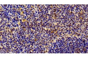Detection of STAT6 in Rat Spleen Tissue using Polyclonal Antibody to Signal Transducer And Activator Of Transcription 6 (STAT6) (STAT6 Antikörper  (AA 557-841))