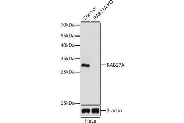 RAB27A Antikörper