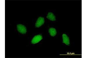 Immunofluorescence of purified MaxPab antibody to RHOXF1 on HeLa cell. (RHOXF1 Antikörper  (AA 1-184))