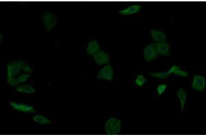Detection of aZGP1 in Human MCF7 cell using Monoclonal Antibody to Alpha-2-Glycoprotein 1, Zinc Binding (aZGP1) (AZGP1 Antikörper  (AA 18-296))