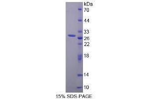 SDS-PAGE analysis of Human STIM1 Protein. (STIM1 Protein)